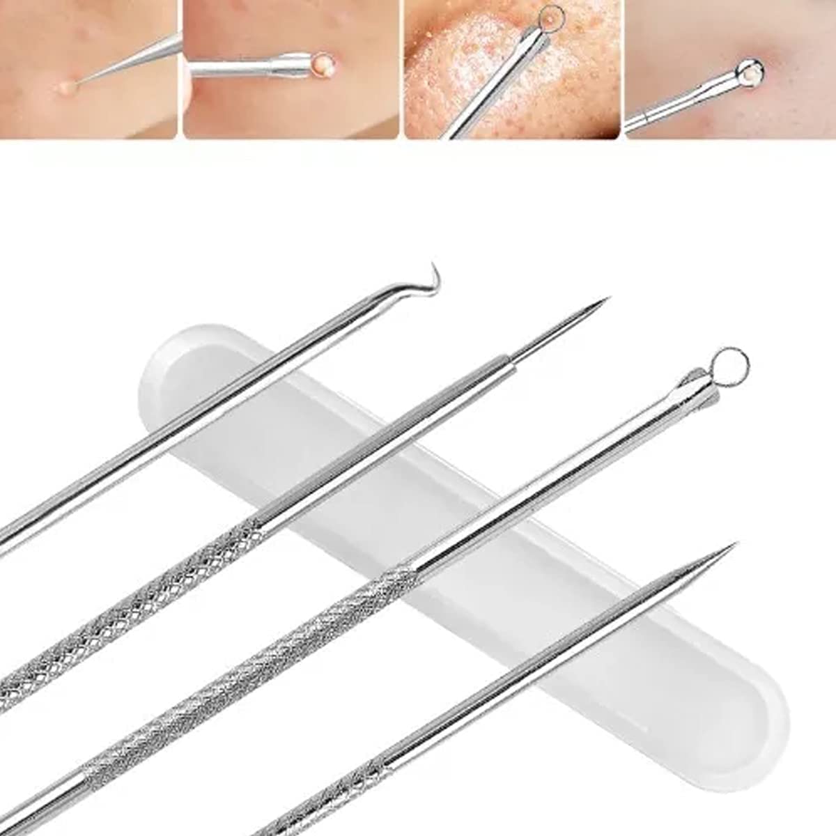 Kit Removedor de Espinillas Anti Acné Puntos Negros (4 Piezas) | Ultramo