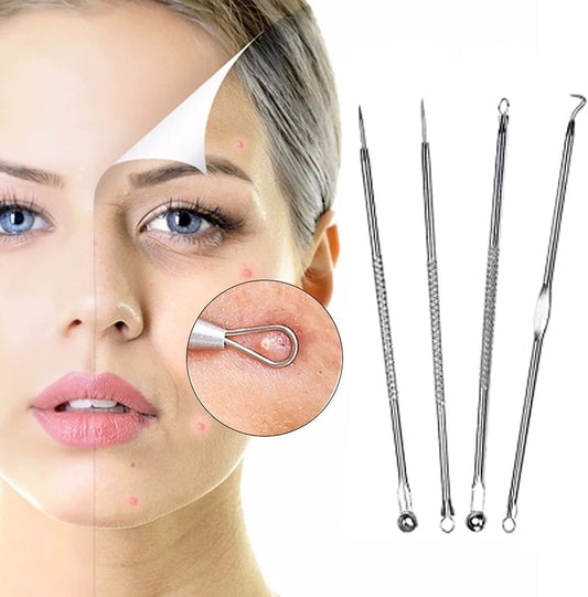 Kit Removedor de Espinillas Anti Acné Puntos Negros (4 Piezas) | Ultramo