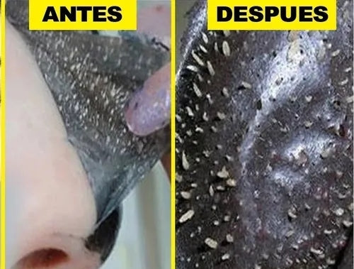 Mascarilla Carbón Activado | More*Beauty